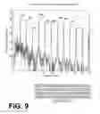 Fig. 07 - Filtering patient signal also for ventilation artifacts
