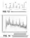 Fig. 11 - Filtering patient signal also for ventilation artifacts