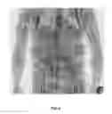 Fig. 09 - Multi-beam stereoscopic X-ray body scanner