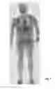 Fig. 10 - Multi-beam stereoscopic X-ray body scanner