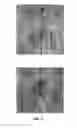 Fig. 11 - Multi-beam stereoscopic X-ray body scanner