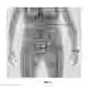 Fig. 12 - Multi-beam stereoscopic X-ray body scanner