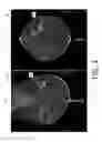 Fig. 04 - System and method for navigating a tomosynthesis stack including automatic focusing