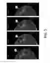 Fig. 06 - System and method for navigating a tomosynthesis stack including automatic focusing