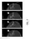 Fig. 08 - System and method for navigating a tomosynthesis stack including automatic focusing
