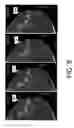 Fig. 09 - System and method for navigating a tomosynthesis stack including automatic focusing