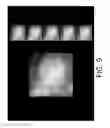 Fig. 10 - System and method for navigating a tomosynthesis stack including automatic focusing