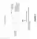 Fig. 18 - Method and apparatus for creation and display of artifact-corrected three dimentional (3D) volumetric data from biplane fluoroscopic image acquisition