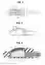 Fig. 03 - Ultrasound endoscope