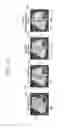 Fig. 13 - Ultrasound diagnostic apparatus and method and computer readable storage medium