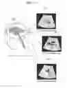 Fig. 17 - Ultrasound diagnostic apparatus and method and computer readable storage medium