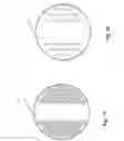 Fig. 15 - SURGICAL CLOSURE SYSTEMS AND METHODS