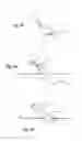 Fig. 38 - SURGICAL CLOSURE SYSTEMS AND METHODS