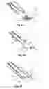 Fig. 43 - SURGICAL CLOSURE SYSTEMS AND METHODS