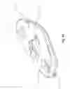 Fig. 59 - SURGICAL CLOSURE SYSTEMS AND METHODS