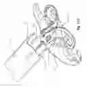 Fig. 75 - SURGICAL CLOSURE SYSTEMS AND METHODS