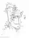 Fig. 03 - Retractor