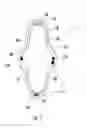 Fig. 02 - Surgical dilator, retractor and mounting pad