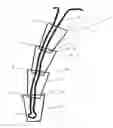 Fig. 01 - Segmented suture anchor