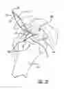 Fig. 09 - Non-sliding soft anchor