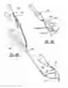 Fig. 10 - Non-sliding soft anchor