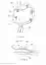 Fig. 03 - ANCHORS AND CINCHING FOR TISSUE OPPOSITION