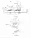 Fig. 05 - ANCHORS AND CINCHING FOR TISSUE OPPOSITION
