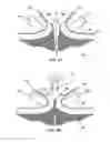 Fig. 04 - Deploying fasteners