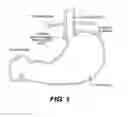 Fig. 02 - Methods and devices for folding and securing tissue