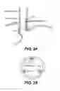 Fig. 16 - Methods and devices for folding and securing tissue