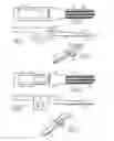 Fig. 03 - SYSTEM FOR JOINING TWO BLOOD VESSELS