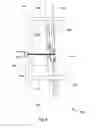 Fig. 10 - Percutaneous Tendon-Muscle-Ligament Approximation Device