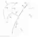 Fig. 01 - Pyloric obstruction device