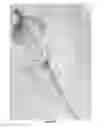 Fig. 06 - Advanced endovascular clip and method of using same