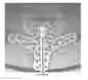 Fig. 11 - Advanced endovascular clip and method of using same