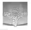 Fig. 14 - Advanced endovascular clip and method of using same