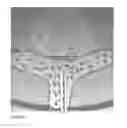 Fig. 16 - Advanced endovascular clip and method of using same