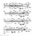 Fig. 07 - BALLOON CATHETER