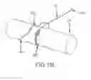 Fig. 50 - SYSTEMS AND METHODS FOR TREATMENT OF COMPRESSED NERVES