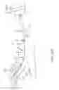 Fig. 56 - SYSTEMS AND METHODS FOR TREATMENT OF COMPRESSED NERVES