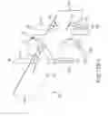 Fig. 63 - SYSTEMS AND METHODS FOR TREATMENT OF COMPRESSED NERVES