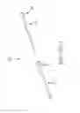 Fig. 70 - SYSTEMS AND METHODS FOR TREATMENT OF COMPRESSED NERVES