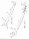 Fig. 84 - SYSTEMS AND METHODS FOR TREATMENT OF COMPRESSED NERVES