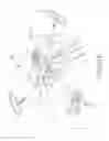 Fig. 93 - SYSTEMS AND METHODS FOR TREATMENT OF COMPRESSED NERVES
