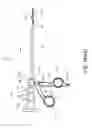 Fig. 100 - Removal device