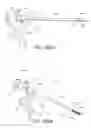 Fig. 119 - Removal device
