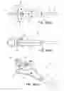 Fig. 32 - Removal device