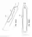 Fig. 82 - Removal device