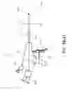 Fig. 87 - Removal device