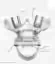 Fig. 01 - Circumferential vertebral column fixation system